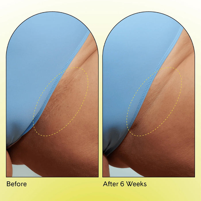 FUR | Ingrown Concentrate